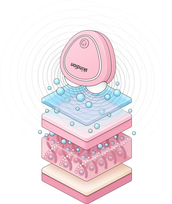 Ilustración de uso de dispositivo de microcorriente en capas de la piel